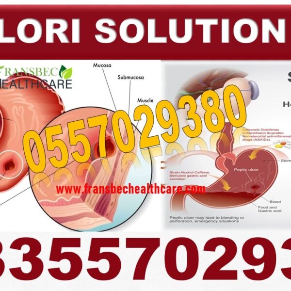 Herbal Medicine for H Pylori Ulcer in Ghana