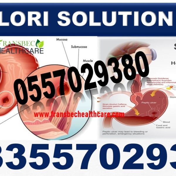 Herbal Supplements for H Pylori Bacteria in Ghana