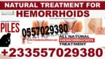 Herbal Supplements for Hemorrhoids in Ghana