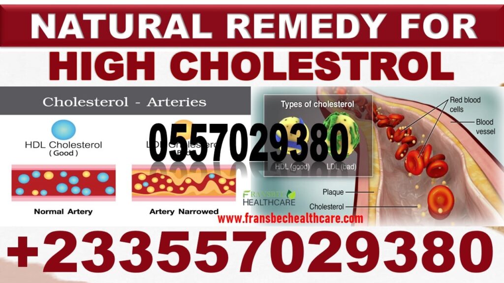 Cholesterol Natural Solution Pack