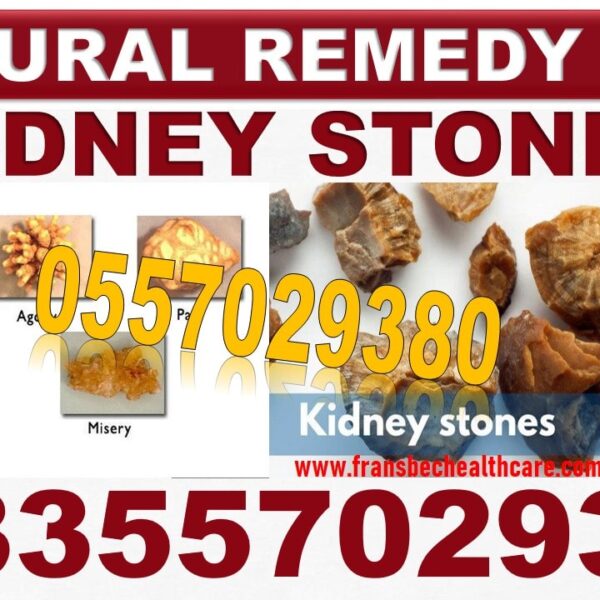 Best Kidney Problem Natural Treatment in Ghana