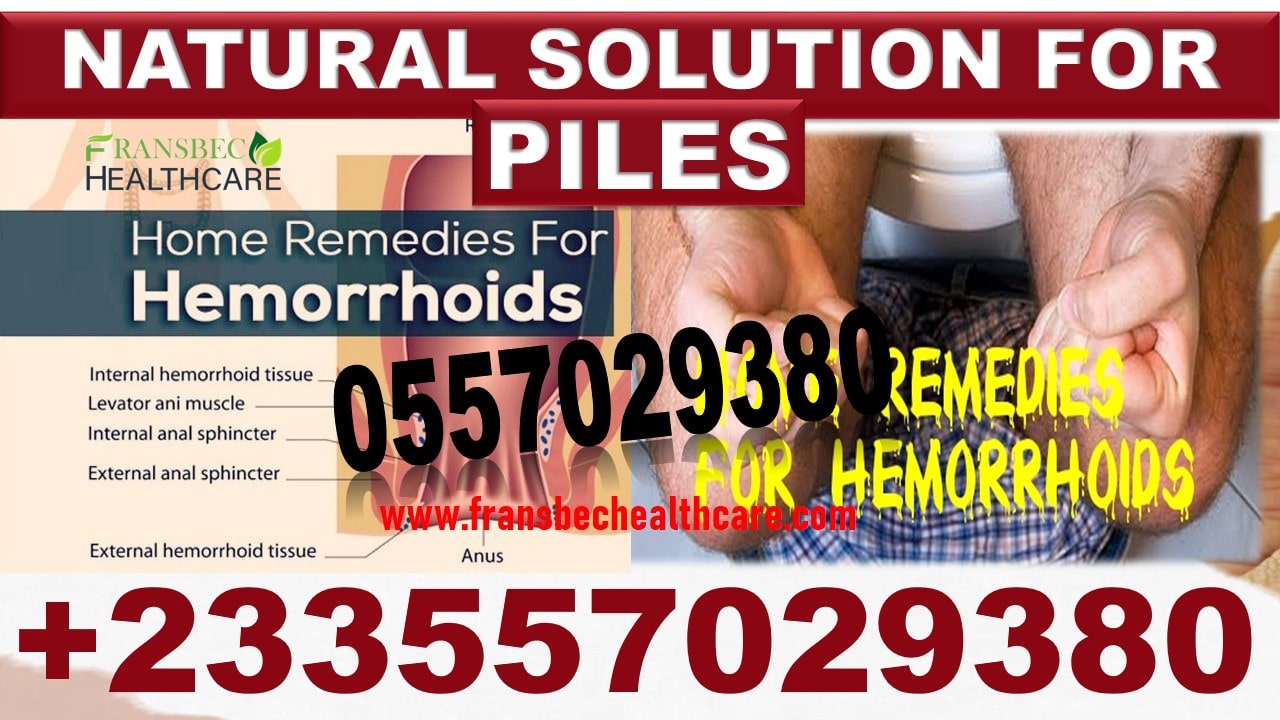 Herbal Treatment for Hemorrhoids in Ghana