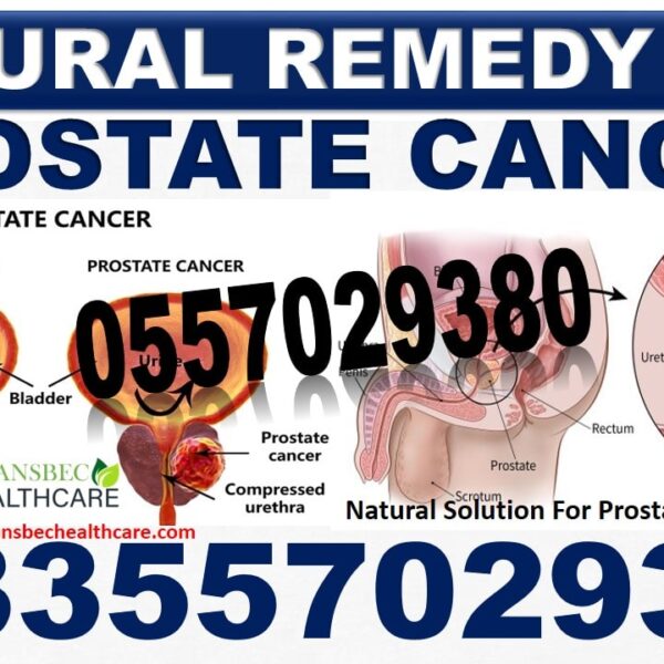 Forever Living Prostate Enlargement Products in Ghana