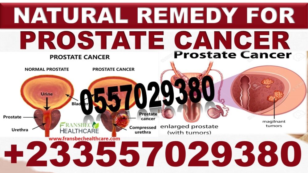 Forever Living Prostate Enlargement Products in Ghana