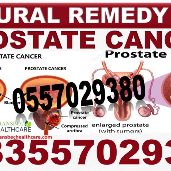 Herbal Products for Prostate Enlargement in Ghana