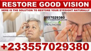 Vision Supplement in Ghana