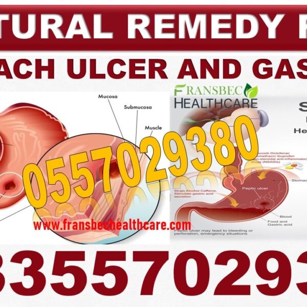 Best H Pylori Bacteria Natural Products in Ghana