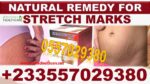 Stretch Marks Natural Pack