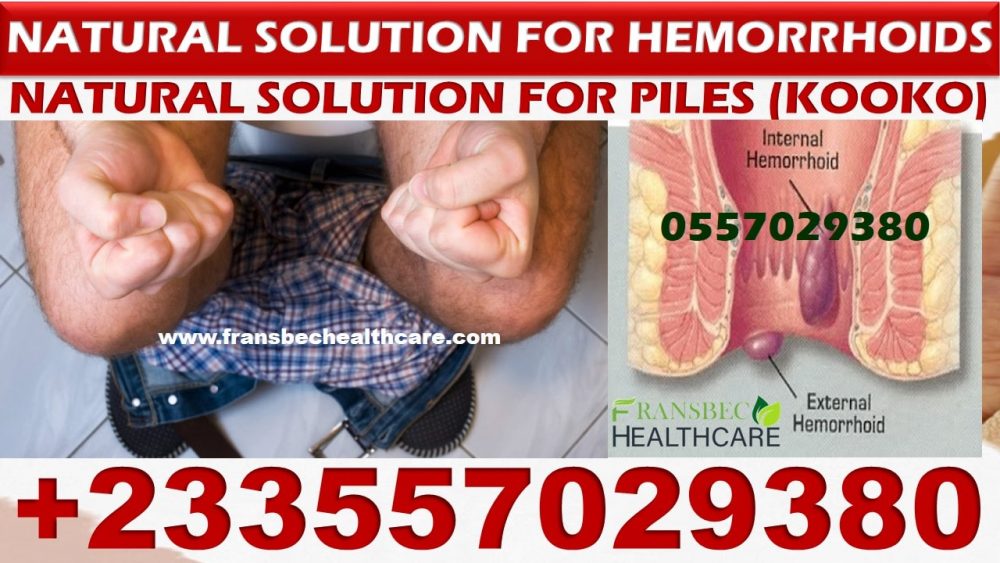 Herbal Treatment for Hemorrhoids in Ghana