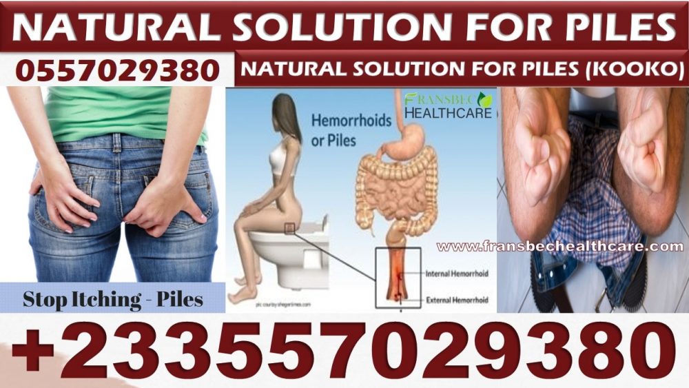 Best Remedy for Hemorrhoids in Ghana