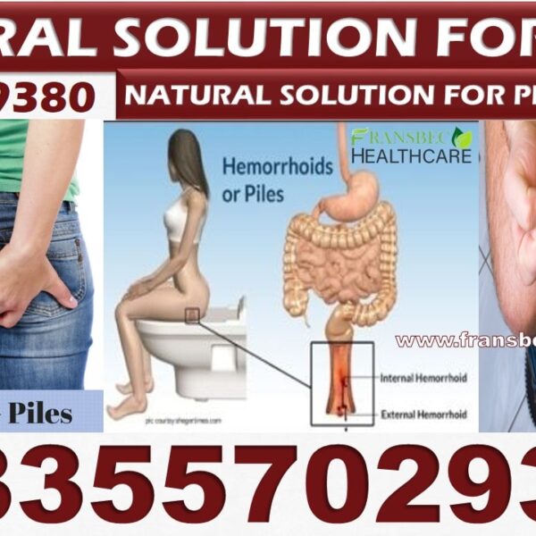 Best Remedy for Hemorrhoids in Ghana