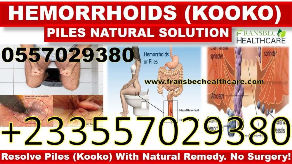 Best Treatment for Hemorrhoids in Ghana